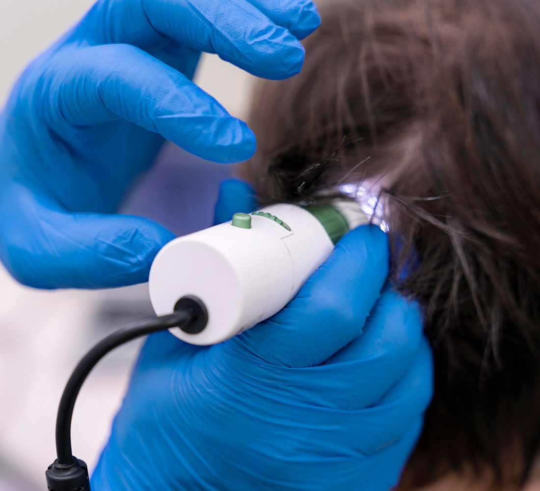 Adavance-hair-growth